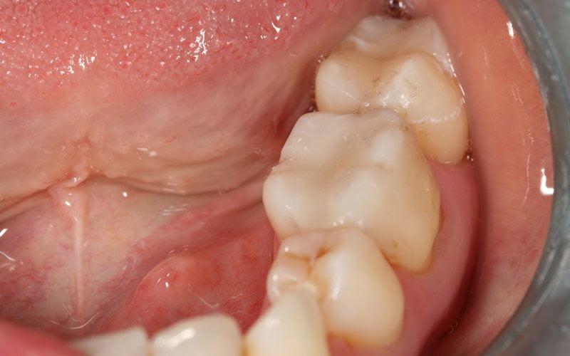After image