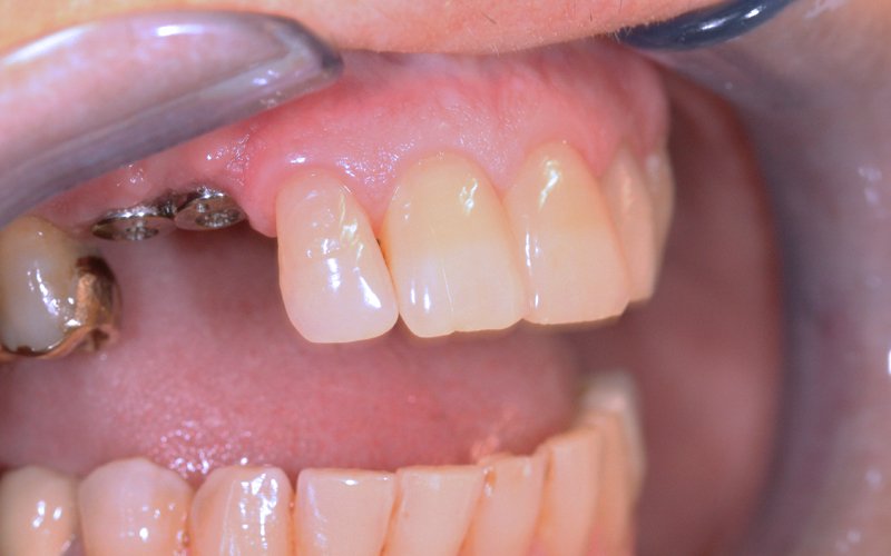 Before image