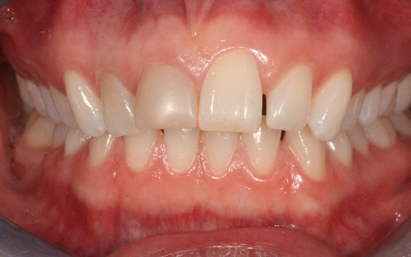 Before image