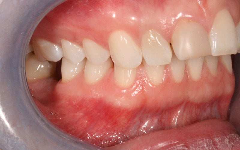 Before image