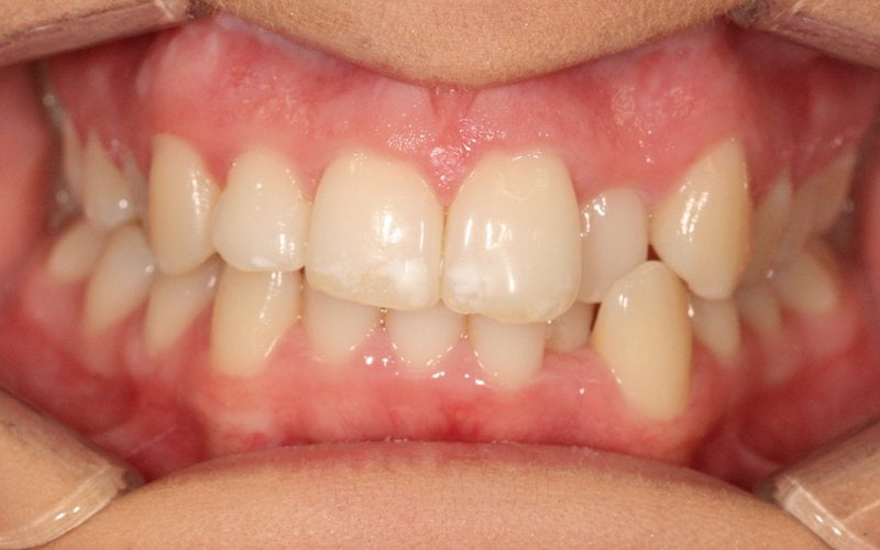 Before image