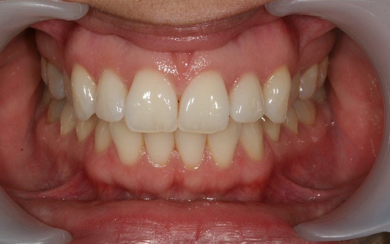 Before image