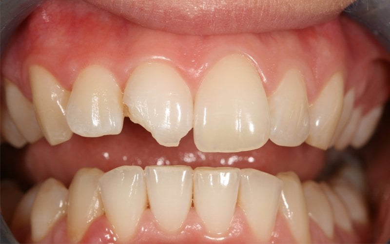Before image