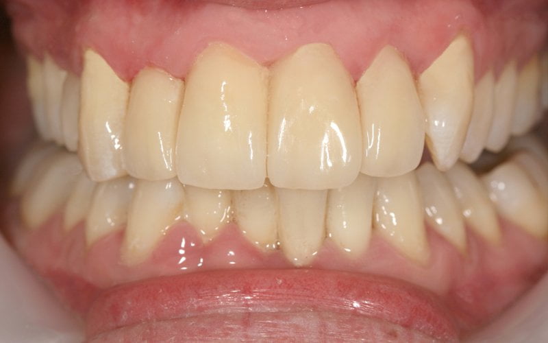 After image