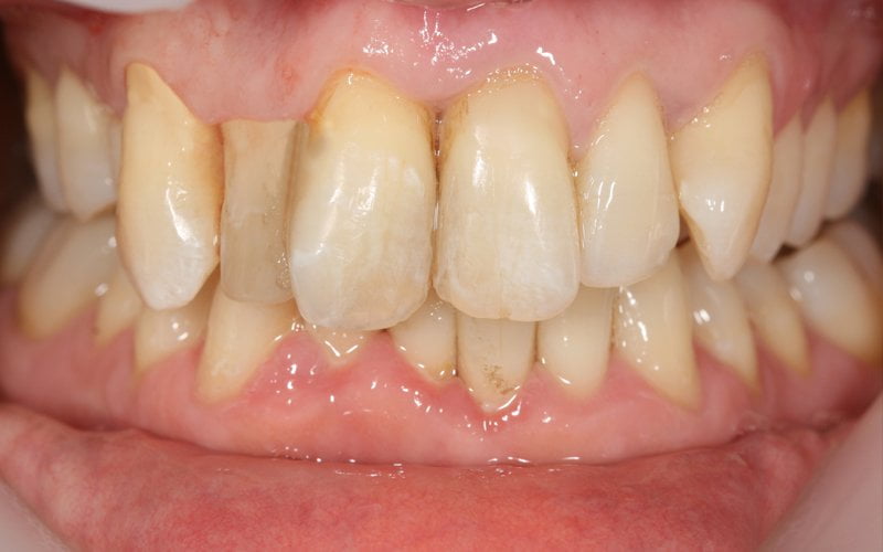Before image