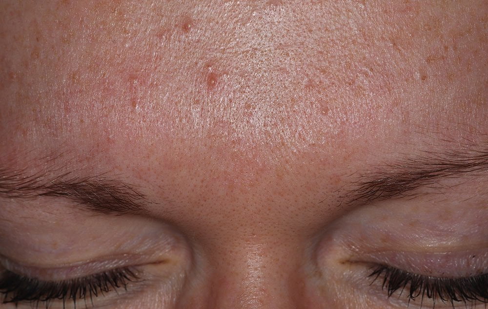 After image