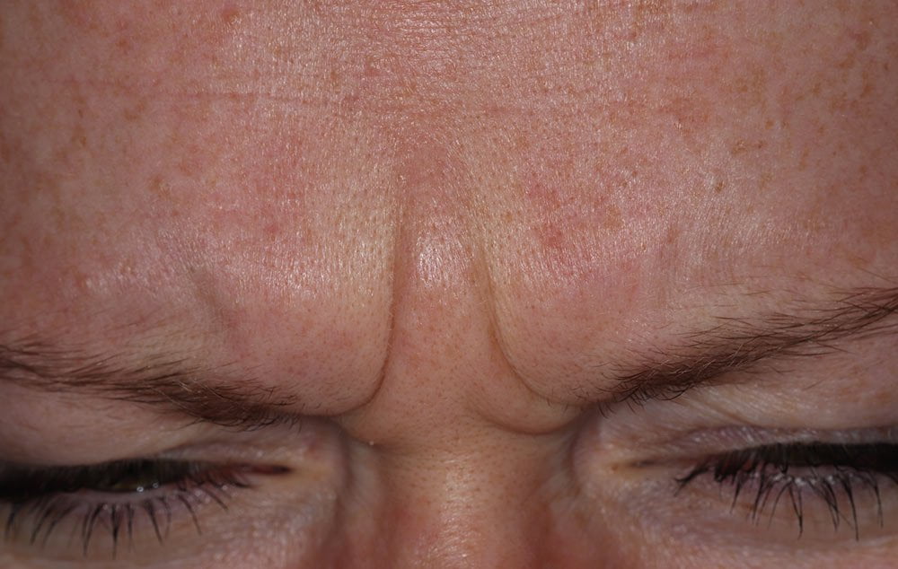 Before image