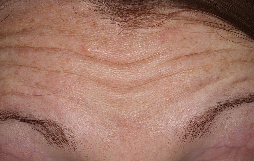 Before image