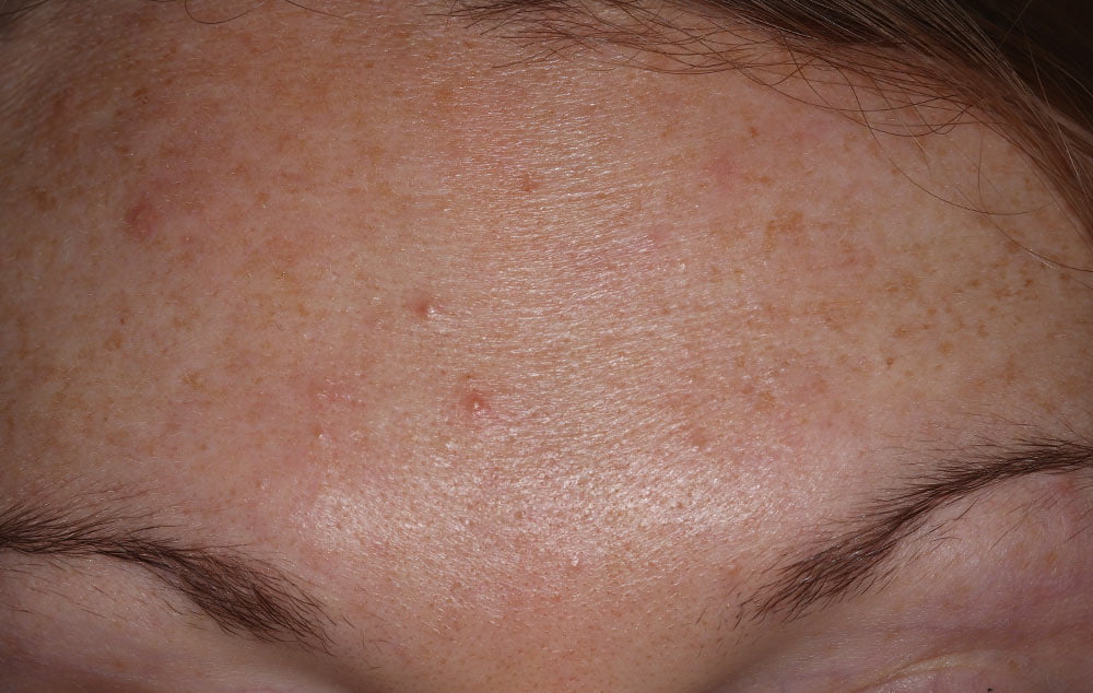 After image