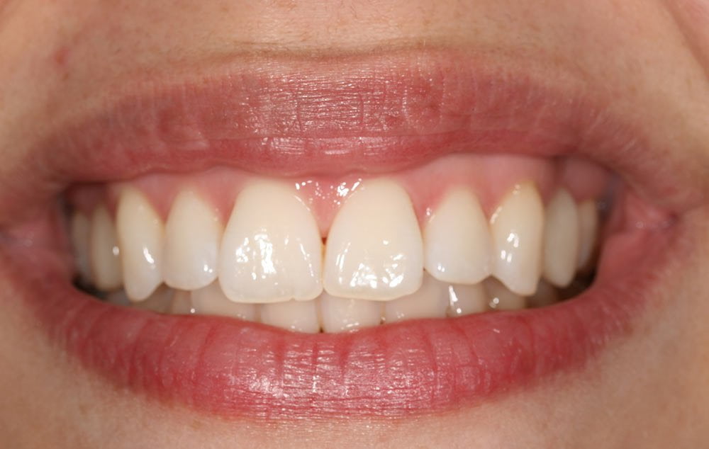 Before image